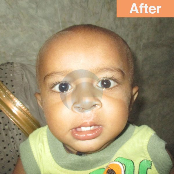 before-after
