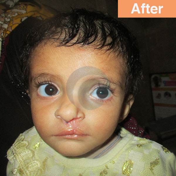 before-after