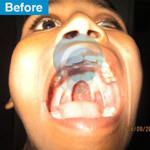 before-after