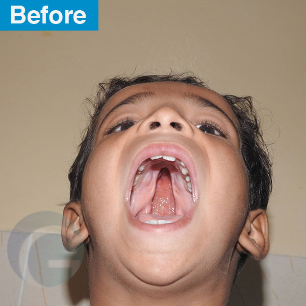 before-after
