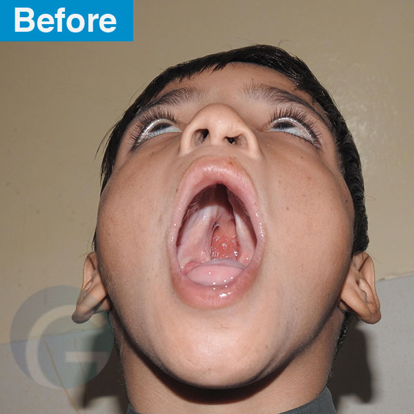 before-after