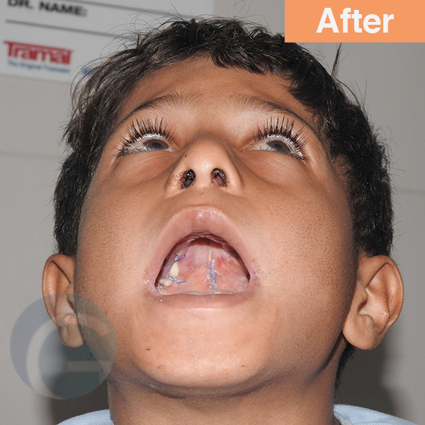before-after