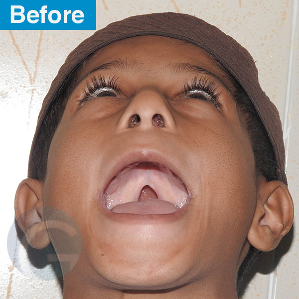 before-after